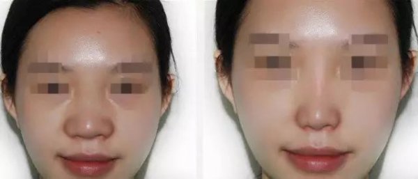 ������ͷ��СͼƬ