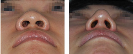 ��ͷ��������С��������Ǯ