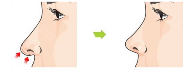 �ǿ״����ǿ���С������Ǯ