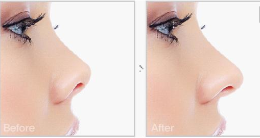 �ǿ���С���������ķ���Ҫ������