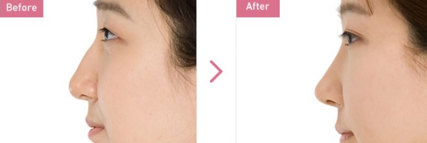 �Ǽ�ʴ���ô����