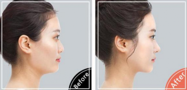 ��ͷ�ʴ������ǰע����������Щ