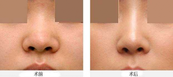 ��ͷ�ʺ���ô����