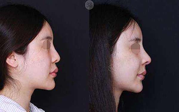 �ǿ���С��������