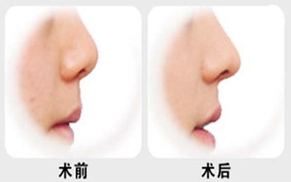 �ǿ׹���ô��С�رǲ�����