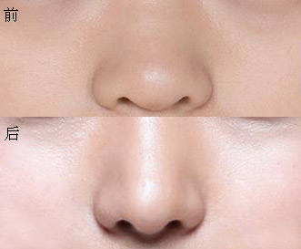 �����ı�ͷ��С����