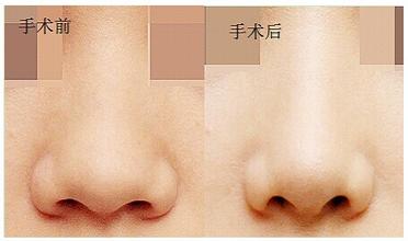 ������С������Ǯ