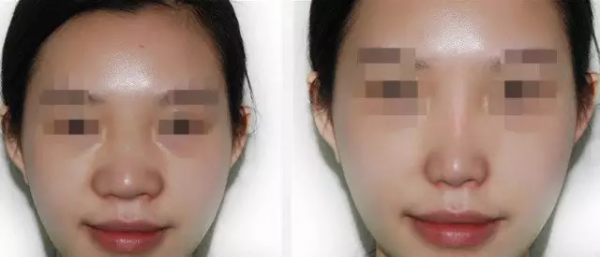 ��ͷ̫����ô��С����