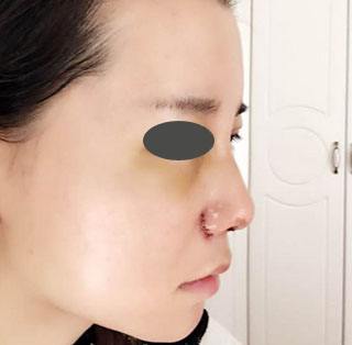 �������ô��С