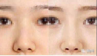 ��ͷ��С�ķ�����������