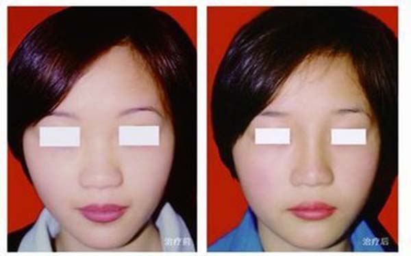 �Ǽ���С����ûָ�