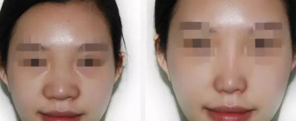 ��ͷ������С�Ա�ͼ