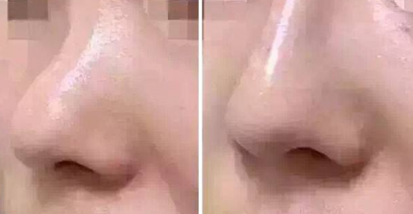 ��ͷ��С����ûָ��������