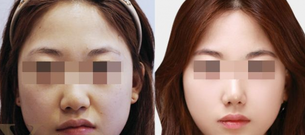 ��ͷ��С������λ���