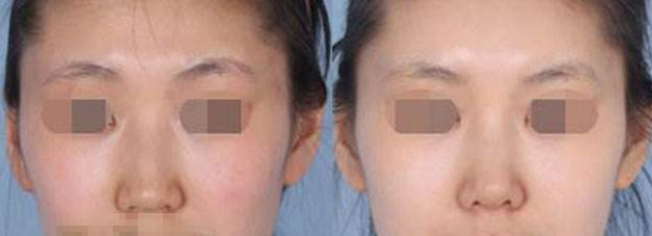 ��ͷ��С�������Ԥ������