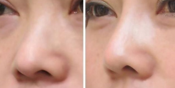 ��ͷ���εļ۸񼰸���������Щ