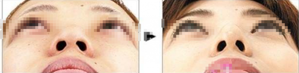 ��ͷ��С����������Ӧ֢״����Щ