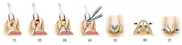 ��ͷ�ʴ������������Ӧ��Ⱥ