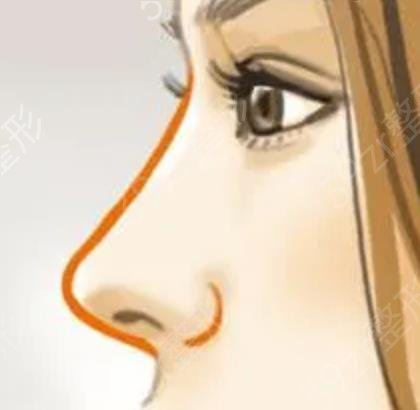 2022黑龙江省做隆鼻专家排名前五公开