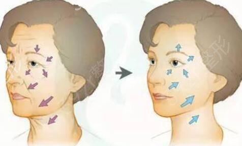 2022-2022����֬�����ҽԺ������top4ǿ�̵�_ר��