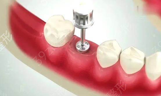 2022����������ֲ��Ʒ��������ǰ���̵�_����ֲ������������ȹ���