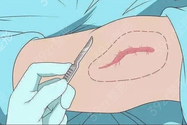 ȥ�̺��ǹ�ҽ���ƻ������ο�