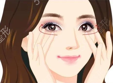 去眼袋挂什么科