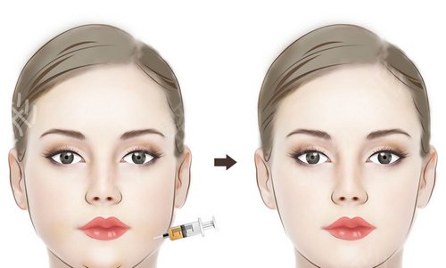 北京协和医院整形科吸脂技术如何