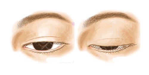 ����PROPOSE����ҽԺ��ô��