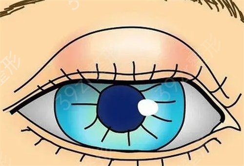 ����PROPOSE����ҽԺ��ô��