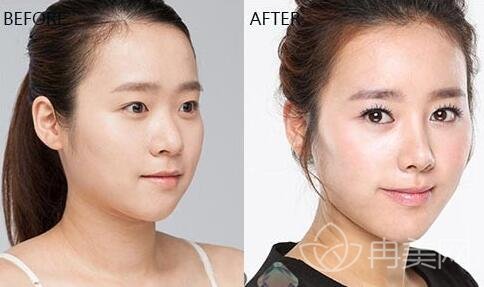 ��ɳ��˼������ҽԺ�۸������Ϯ