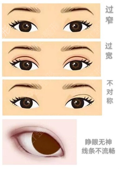 国内双眼皮修复专家排名