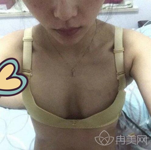 无锡瑞丽整形医院皮先荣怎么样