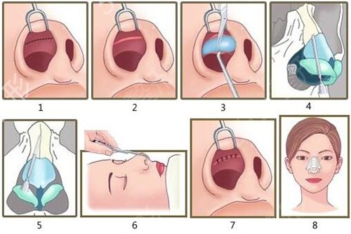 2022太原市整形美容院排名榜前四名单发布