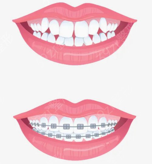 2022深圳口腔公立医院排名前四名单揭晓