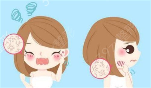 广州哪家医美做面部拉皮好