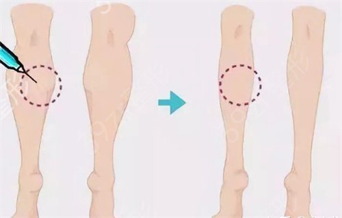 ֣��������ҽԺ�����ο���