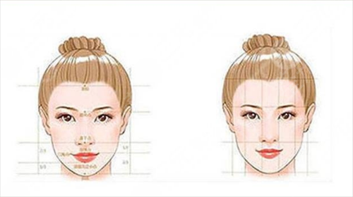 在韩国原辰整形做的改脸型
