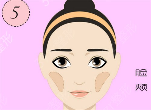 绍兴上虞艺美做的脂肪填充全脸