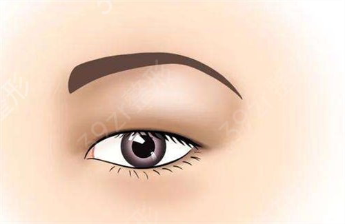 宁波割双眼皮医生哪个好