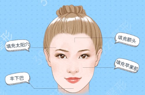 面部填充手术价格多少钱