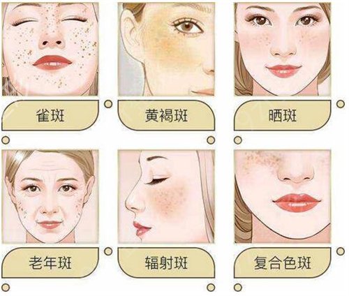 艾玛整形的嫩肤项目做的好不好