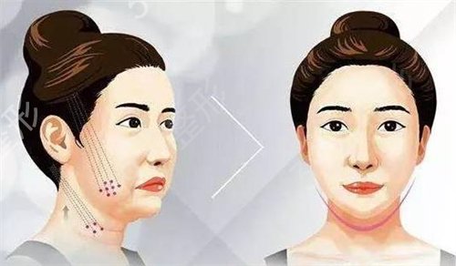 �Ϸ�����ҽԺ���а���ѡtop4