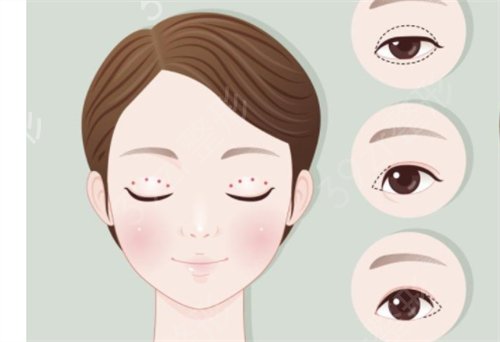 甘肃兰州整形医院哪个好