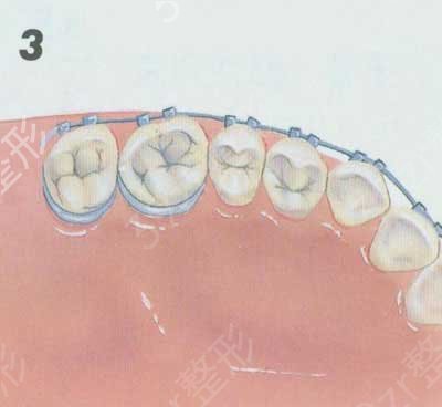 ������ǻ�õ�3��ҽԺ���˹���