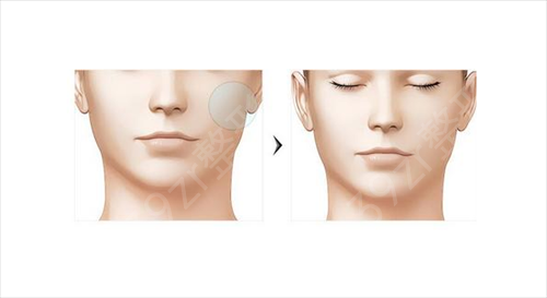 2022武汉磨骨好的医院排名榜