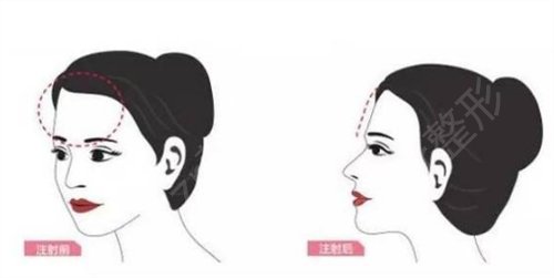 2022����֬������ļҺ�