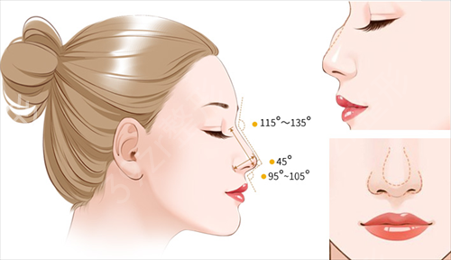 成都隆鼻医院去哪家好呀
