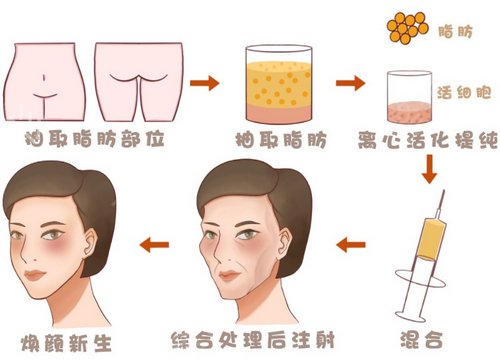 �����ļ�ҽԺ��֬������