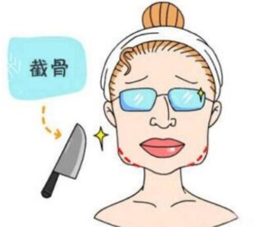 上海磨骨医院哪家好